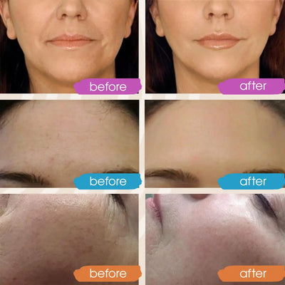 Facial Serums Skin Care Set  Moisturizing Retinol +Hyaluronic Acid + Vitamin C Serum Brightening Firming, & Hydrating Face Serum