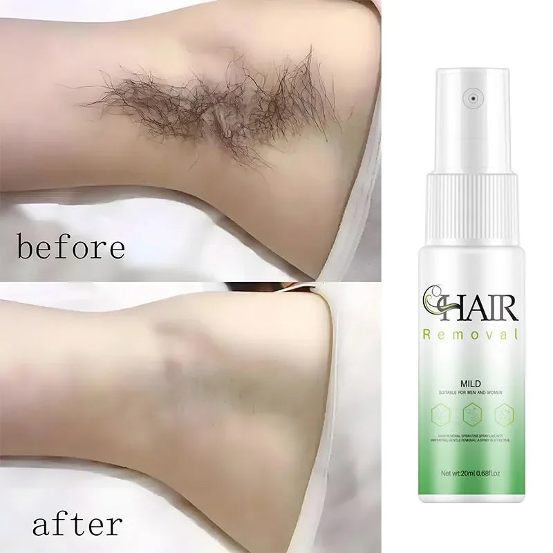 Hair Removal Spray Powerful Cream Healthy Painless Remover Growth Inhibitor Female Body Care