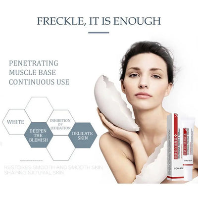 Whitening Niacinamide Face Cream – Brightening Moisturizing Serum, Anti-Freckle Formula to Lighten Dark Spots & Improve Skin Tone Care.